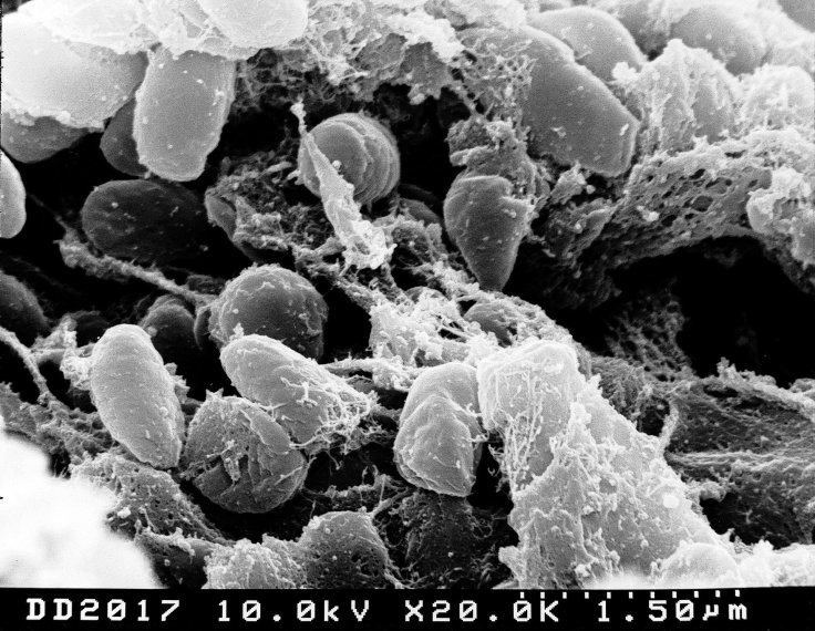 pestis-bacterium